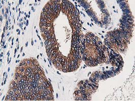 m03062 anti osbp1 osbp mouse monoclonal antibody clone id oti1f2 ihc testing 7