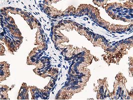 m03062 anti osbp1 osbp mouse monoclonal antibody clone id oti1f2 ihc testing 8