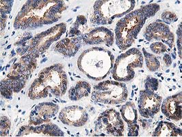 m03062 anti osbp1 osbp mouse monoclonal antibody clone id oti1f2 ihc testing 9