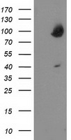 HEK293T cells were transfected with the pCMV6-ENTRY control (Left lane) or pCMV6-ENTRY OSBP (Right lane) cDNA for 48 hrs and lysed