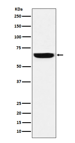 Western blot analysis of GBP1 expression in HeLa cell lysate