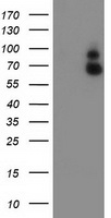 HEK293T cells were transfected with the pCMV6-ENTRY control (Left lane) or pCMV6-ENTRY GBP1 (Right lane) cDNA for 48 hrs and lysed