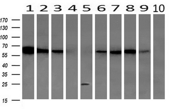 Western blot analysis of extracts (10ug) from 10 Human tissue by using anti-GBP1 monoclonal antibody at 1:200 (1: Testis; 2: Omentum; 3: Uterus; 4: Breast; 5: Brain; 6: Liver; 7: Ovary; 8: Thyroid gland; 9: colon;10: spleen)