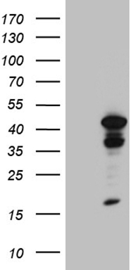 HEK293T cells were transfected with the pCMV6-ENTRY control (Left lane) or pCMV6-ENTRY TINF2 (Right lane) cDNA for 48 hrs and lysed