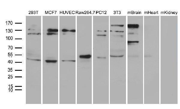 Western blot analysis of extracts (35ug) from 6 different cell lines and 3 different tissue lines by using anti-TINF2 monoclonal antibody (1:500)