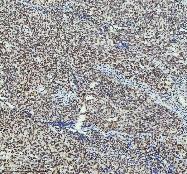 m03073 mta2 primary antibodies ihc testing 2