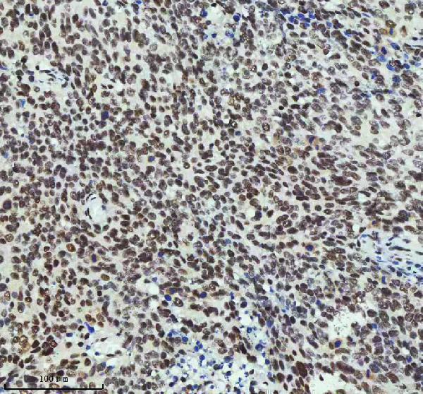 m03073 mta2 primary antibodies ihc testing 3