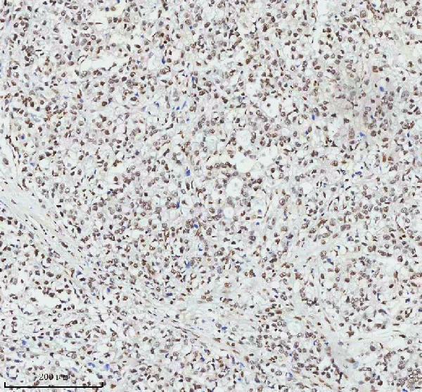 m03073 mta2 primary antibodies ihc testing 4