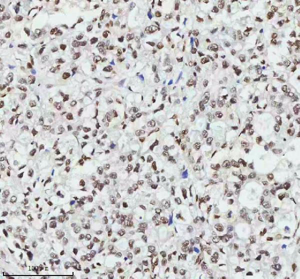m03073 mta2 primary antibodies ihc testing 5