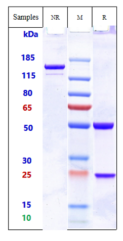 Anti-ADAM9 Reference Antibody (Imgc936) on SDS-PAGE under reducing (R) condition