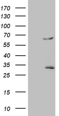 HEK293T cells were transfected with the pCMV6-ENTRY control (Left lane) or pCMV6-ENTRY TRAF5 (Right lane) cDNA for 48 hrs and lysed