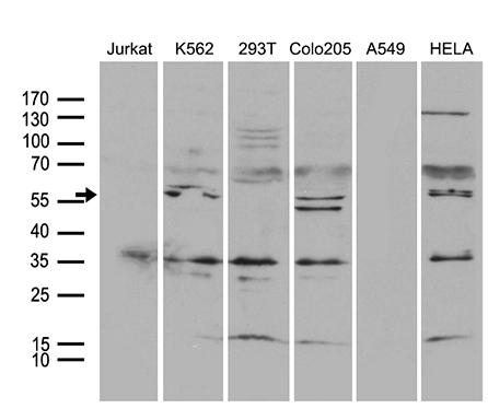 Western blot analysis of extracts (35ug) from 6 different cell lines by using anti-TRAF5 monoclonal antibody (1:500)