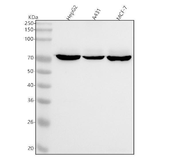  Western blot analysis of ZBTB7A using anti-ZBTB7A antibody (M03081)