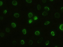 Anti-GSC mouse monoclonal antibody (M03084-1) immunofluorescent staining of HeLa cells transiently transfected by pCMV6-ENTRY GSC