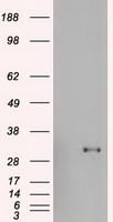 HEK293T cells were transfected with the pCMV6-ENTRY control (Left lane) or pCMV6-ENTRY GSC (Right lane) cDNA for 48 hrs and lysed