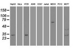 Western blot analysis of extracts (35ug) from 9 different cell lines by using anti-GSC monoclonal antibody