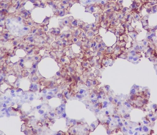 Immunohistochemical analysis of paraffin-embedded mouse lung, using AQP5 Antibody