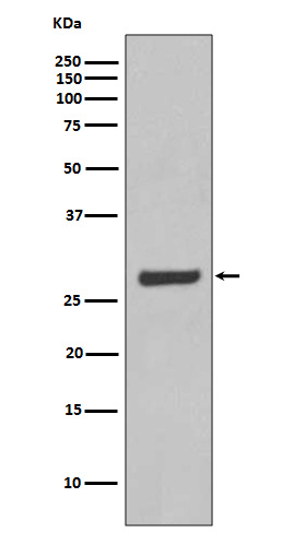 Western blot analysis of AQP5 expression in SW480 cell lysate