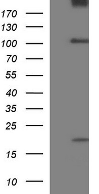 HEK293T cells were transfected with the pCMV6-ENTRY control (Left lane) or pCMV6-ENTRY UNC13D (Right lane) cDNA for 48 hrs and lysed