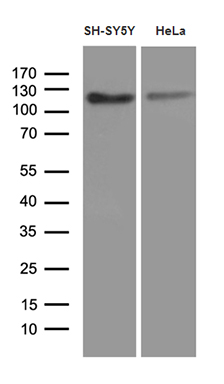 m03090 anti fe65 apbb1 mouse monoclonal antibody clone id oti3h9 wb testing 2