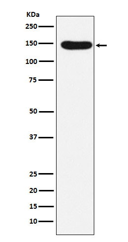 Western blot analysis of Desmoglein 3 expression in A431 cell lysate