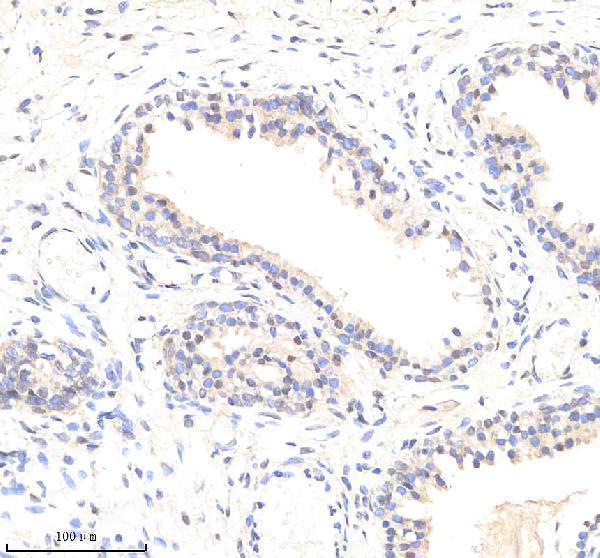 m03095 1 eif4a3 primary antibodies ihc testing 3