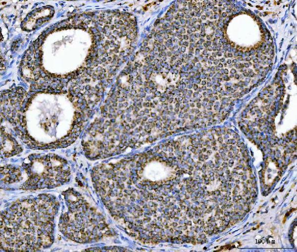 m03096 3 aco2 primary antibodies ihc testing 2