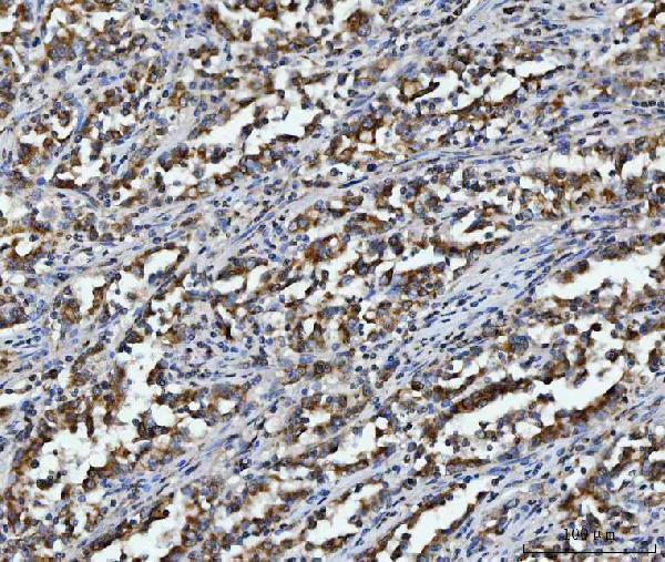 m03096 3 aco2 primary antibodies ihc testing 3
