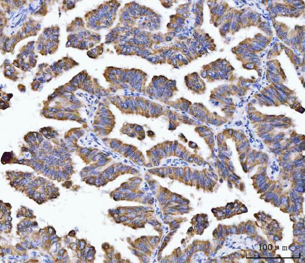 m03096 3 aco2 primary antibodies ihc testing 5