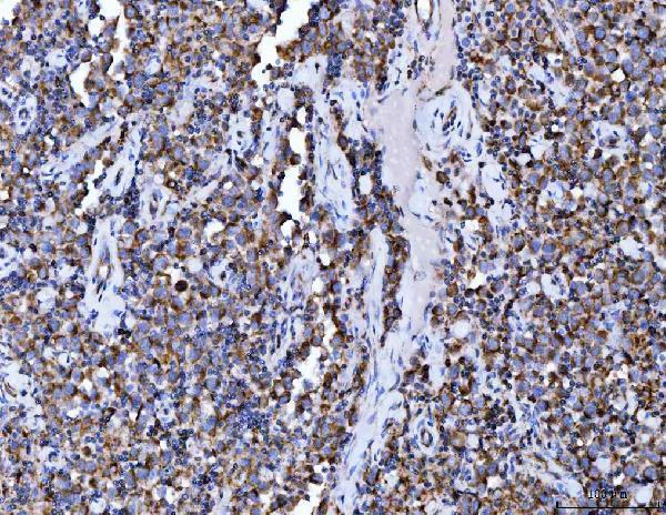 m03096 3 aco2 primary antibodies ihc testing 6