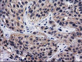 m03100 anti hsp40 dnajb1 mouse monoclonal antibody clone id oti1e9 ihc testing 5