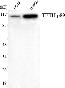m03103 ercc3 primary antibodies wb testing 1