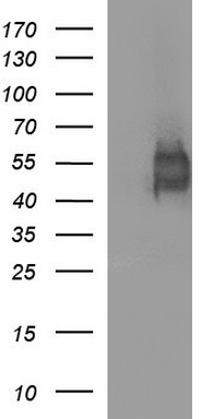 HEK293T cells were transfected with the pCMV6-ENTRY control (Left lane) or pCMV6-ENTRY IL1R2 (Right lane) cDNA for 48 hrs and lysed
