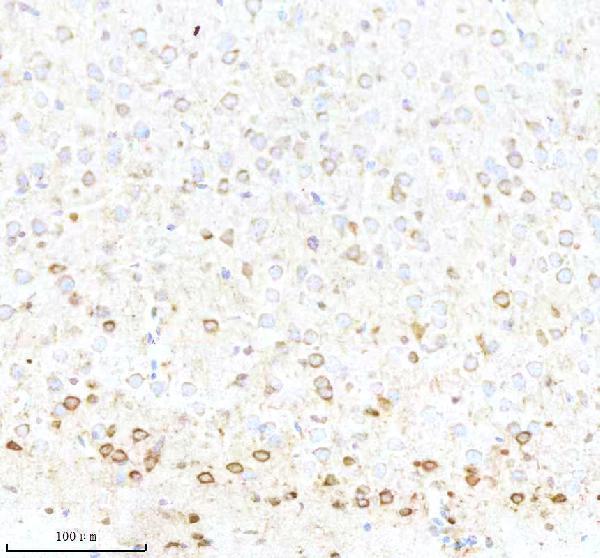 m03107 bnip3l primary antibodies ihc testing 11