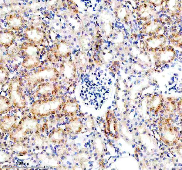m03107 bnip3l primary antibodies ihc testing 15