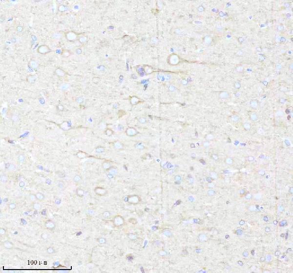 m03107 bnip3l primary antibodies ihc testing 17