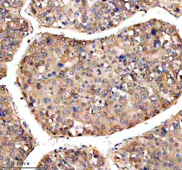 m03107 bnip3l primary antibodies ihc testing 3
