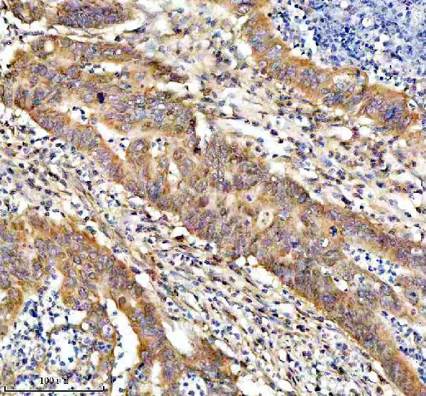 m03107 bnip3l primary antibodies ihc testing 4