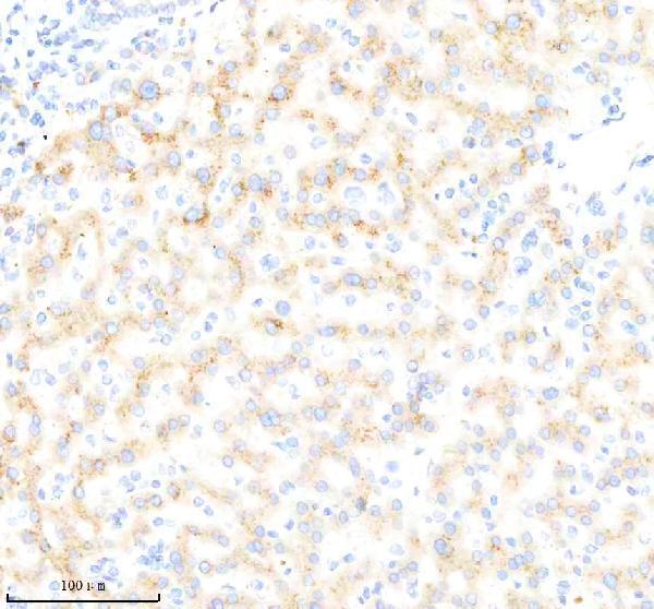 m03117 bdkrb2 primary antibodies ihc testing 2