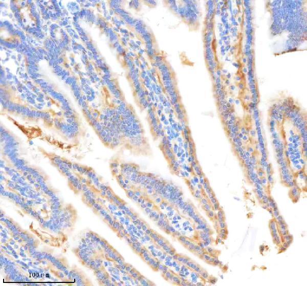 m03117 bdkrb2 primary antibodies ihc testing 3