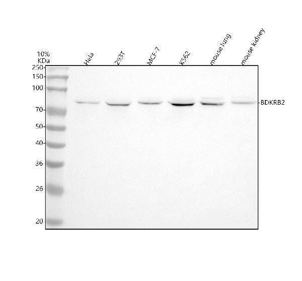 m03117 bdkrb2 primary antibodies wb testing 1