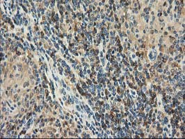 m03123 1 anti catalase cat mouse monoclonal antibody clone id oti1b8 ihc testing 10