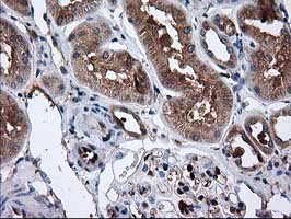m03123 1 anti catalase cat mouse monoclonal antibody clone id oti1b8 ihc testing 11