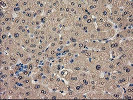 m03123 1 anti catalase cat mouse monoclonal antibody clone id oti1b8 ihc testing 12