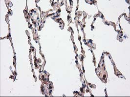 m03123 1 anti catalase cat mouse monoclonal antibody clone id oti1b8 ihc testing 13