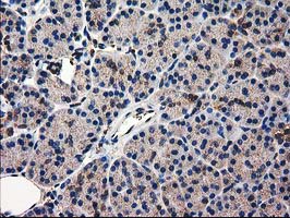m03123 1 anti catalase cat mouse monoclonal antibody clone id oti1b8 ihc testing 3