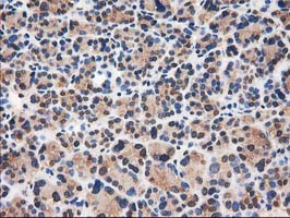 m03123 1 anti catalase cat mouse monoclonal antibody clone id oti1b8 ihc testing 4