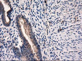 m03123 1 anti catalase cat mouse monoclonal antibody clone id oti1b8 ihc testing 5
