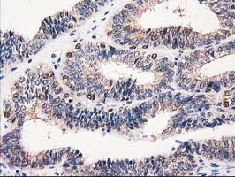 m03123 1 anti catalase cat mouse monoclonal antibody clone id oti1b8 ihc testing 6