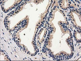 m03123 1 anti catalase cat mouse monoclonal antibody clone id oti1b8 ihc testing 7